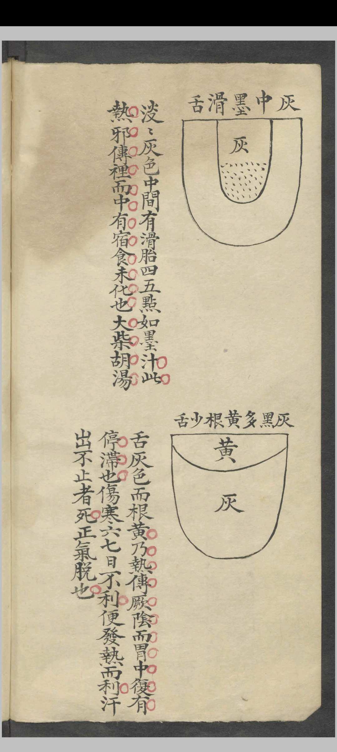 图片[4]-中华古籍网-专注古书收集舌胎总论   1900-中华古籍网-专注古书收集中华古籍网-专注古书收集