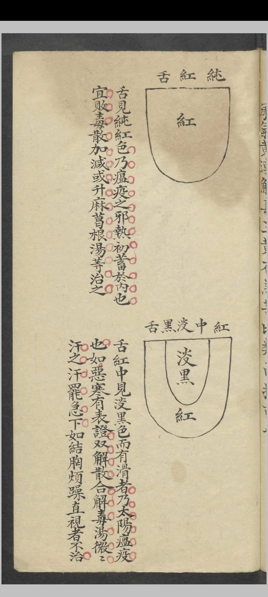 图片[6]-中华古籍网-专注古书收集舌胎总论   1900-中华古籍网-专注古书收集中华古籍网-专注古书收集