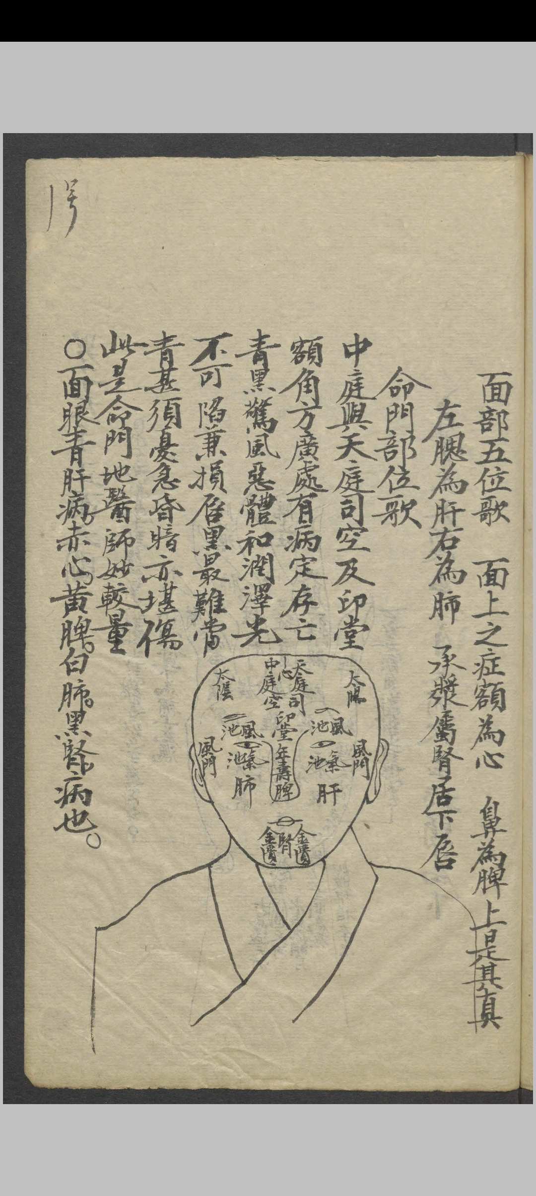 图片[17]-中华古籍网-专注古书收集针灸全图汇编   1900-中华古籍网-专注古书收集中华古籍网-专注古书收集