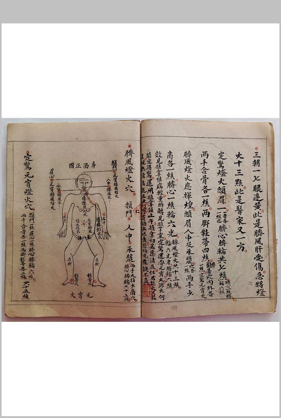 图片[9]-中华古籍网-专注古书收集周夏二氏家傅推拿秘诀-中华古籍网-专注古书收集中华古籍网-专注古书收集