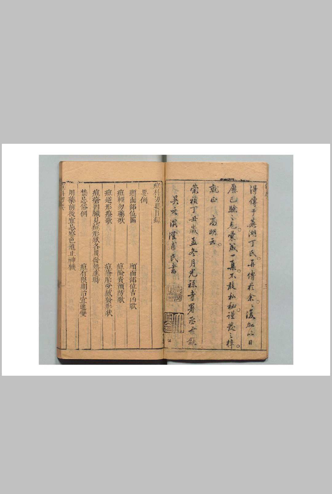 图片[2]中华古籍网-专注古书收集痘科切要 吴元溟（明） 毓秀堂中华古籍网-专注古书收集中华古籍网