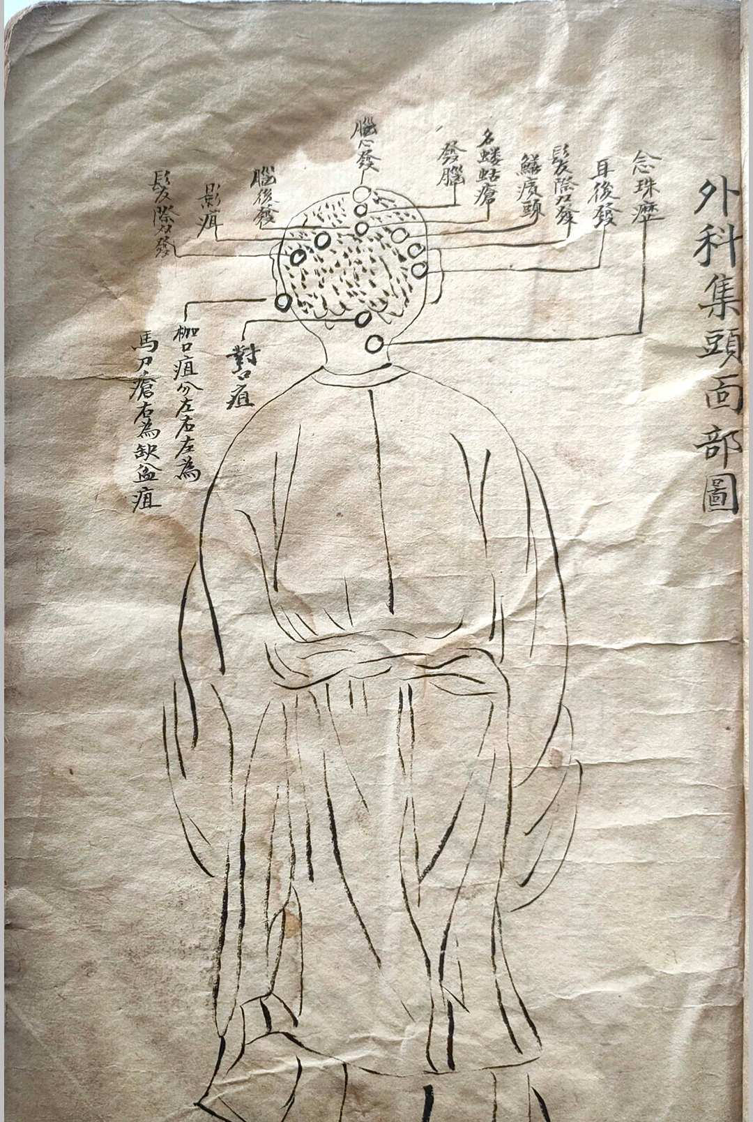 图片[6]-中华古籍网-专注古书收集外科集要-中华古籍网-专注古书收集中华古籍网-专注古书收集