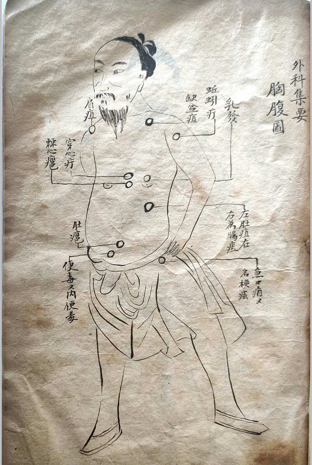 图片[12]-中华古籍网-专注古书收集外科集要-中华古籍网-专注古书收集中华古籍网-专注古书收集