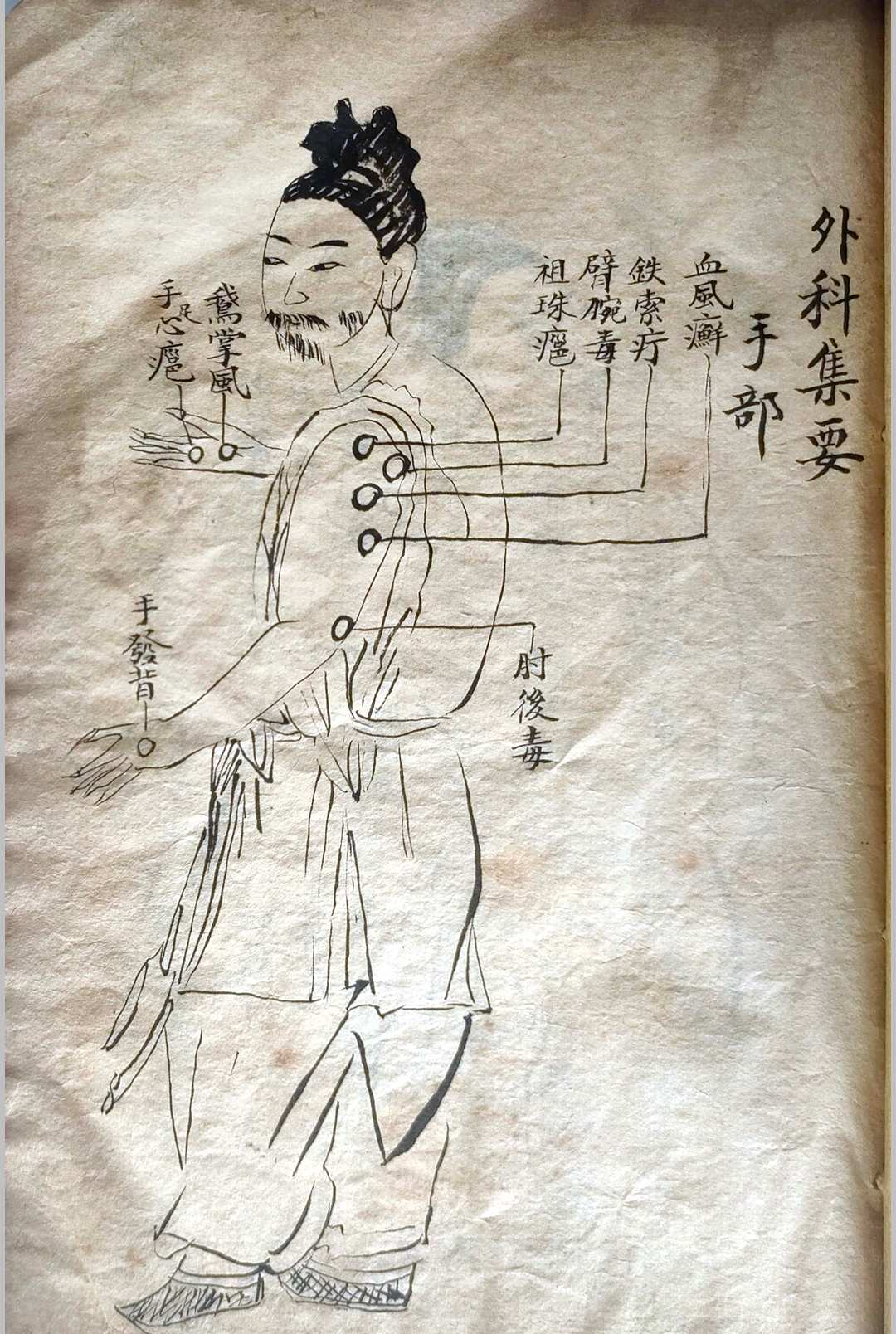 图片[7]-中华古籍网-专注古书收集外科集要-中华古籍网-专注古书收集中华古籍网-专注古书收集