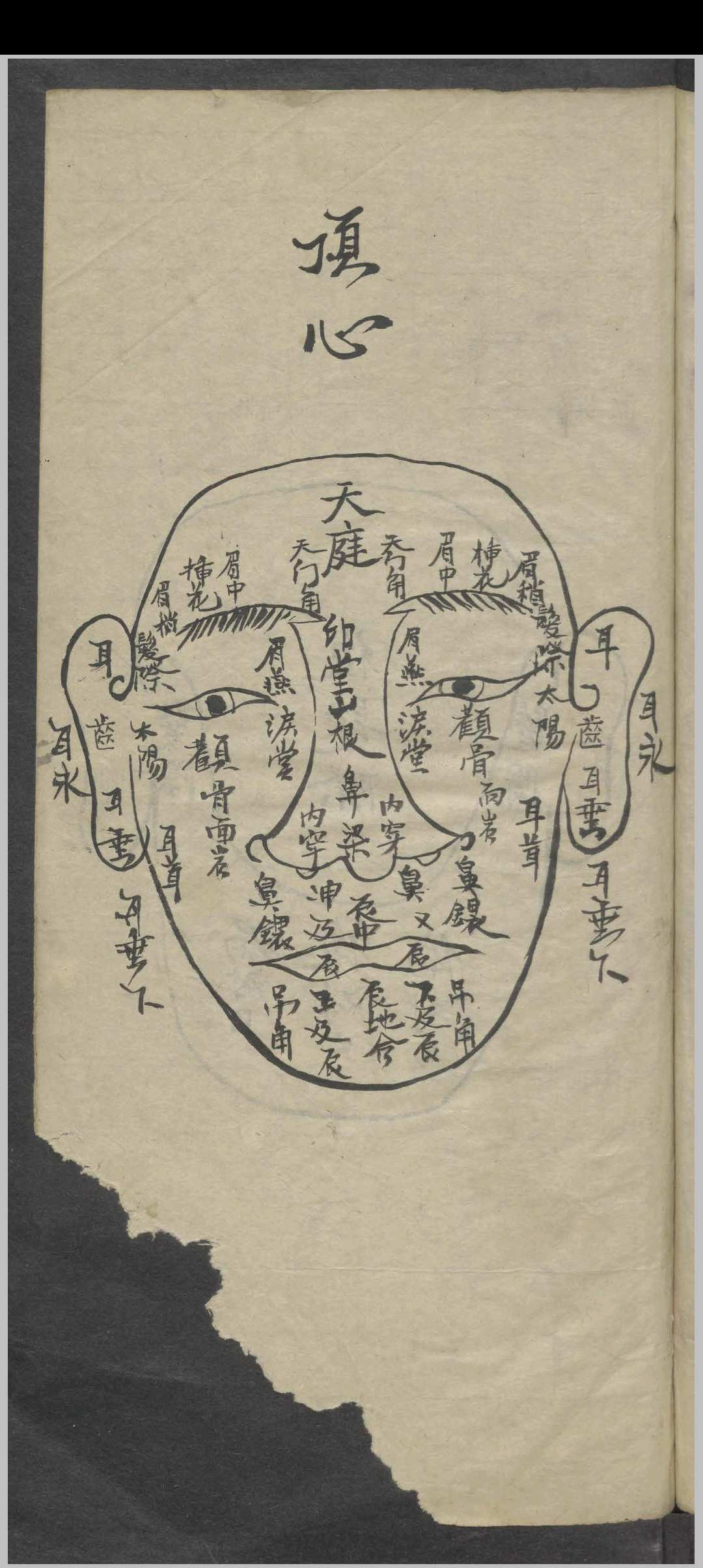 图片[2]-中华古籍网-专注古书收集外科药方集-中华古籍网-专注古书收集中华古籍网-专注古书收集
