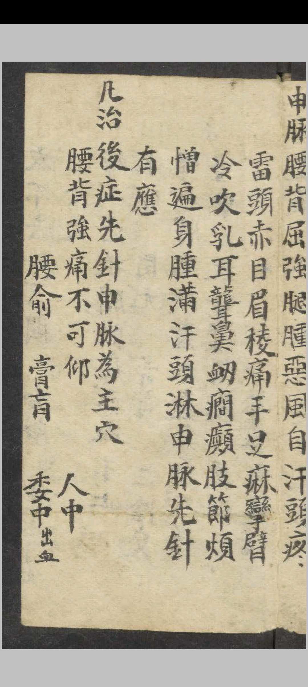 图片[3]-中华古籍网-专注古书收集眼科针灸要穴图   1900-中华古籍网-专注古书收集中华古籍网-专注古书收集