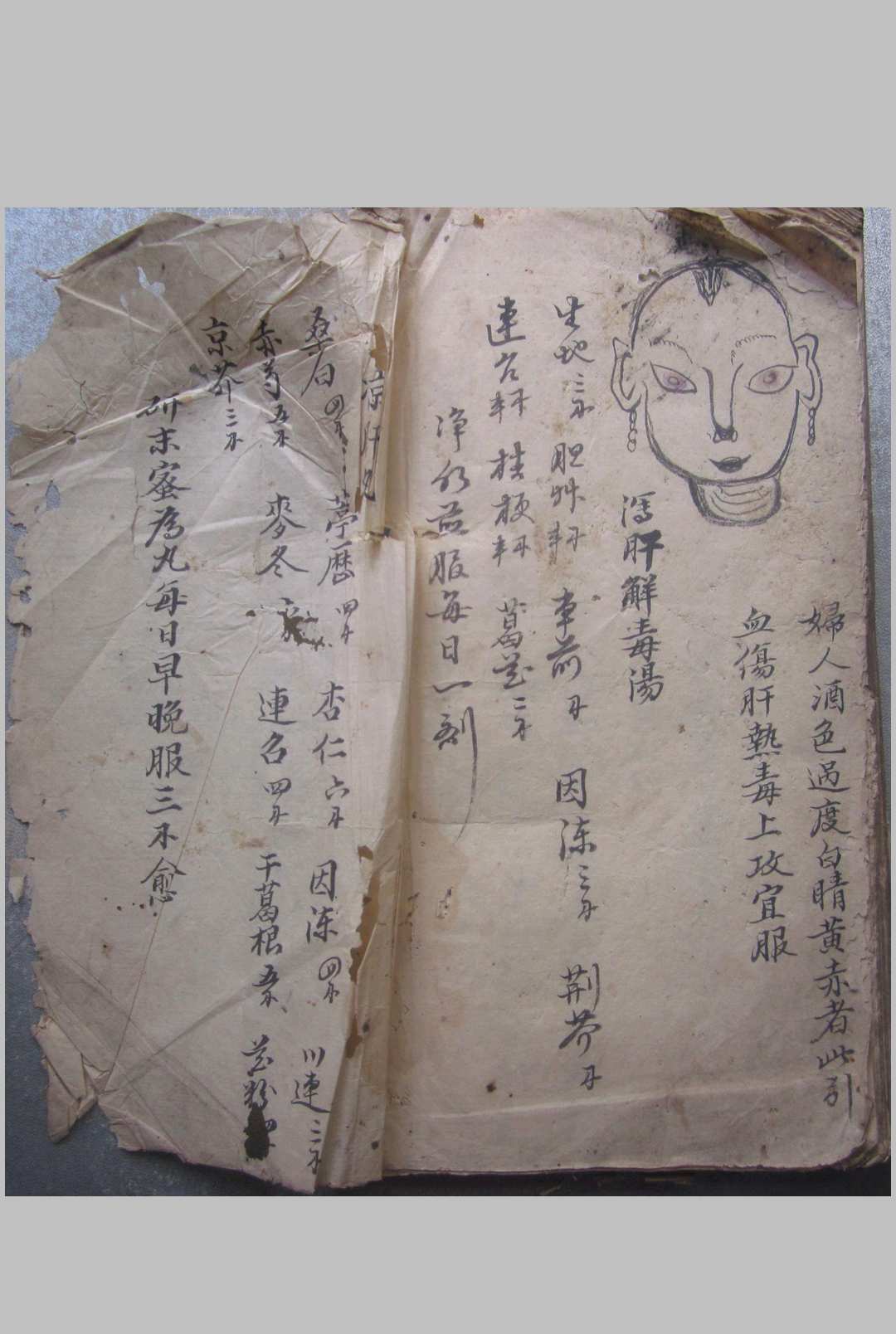 图片[12]-中华古籍网-专注古书收集眼科秘方 抄本-中华古籍网-专注古书收集中华古籍网-专注古书收集