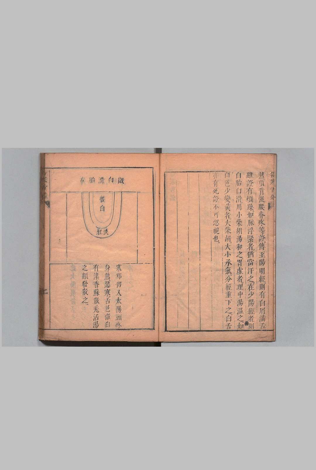 图片[3]中华古籍网-专注古书收集伤寒舌鉴 张登 邵之鹏,清康熙7年中华古籍网-专注古书收集中华古籍网
