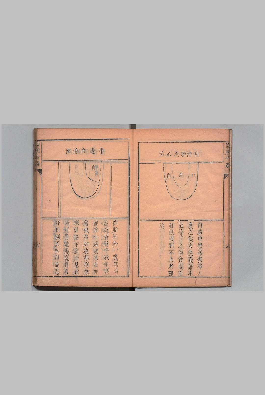 图片[4]中华古籍网-专注古书收集伤寒舌鉴 张登 邵之鹏,清康熙7年中华古籍网-专注古书收集中华古籍网