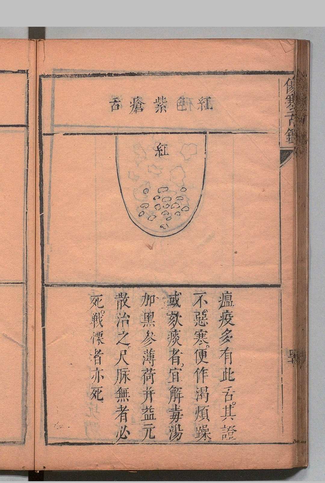 图片[5]中华古籍网-专注古书收集伤寒舌鉴 张登 邵之鹏,清康熙7年中华古籍网-专注古书收集中华古籍网
