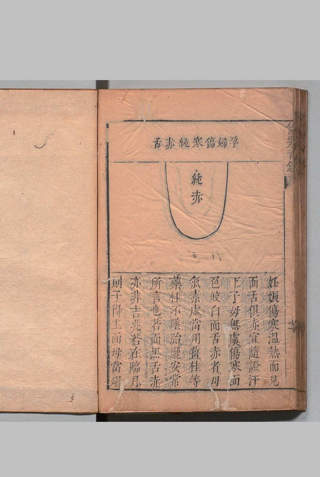 图片[6]中华古籍网-专注古书收集伤寒舌鉴 张登 邵之鹏,清康熙7年中华古籍网-专注古书收集中华古籍网