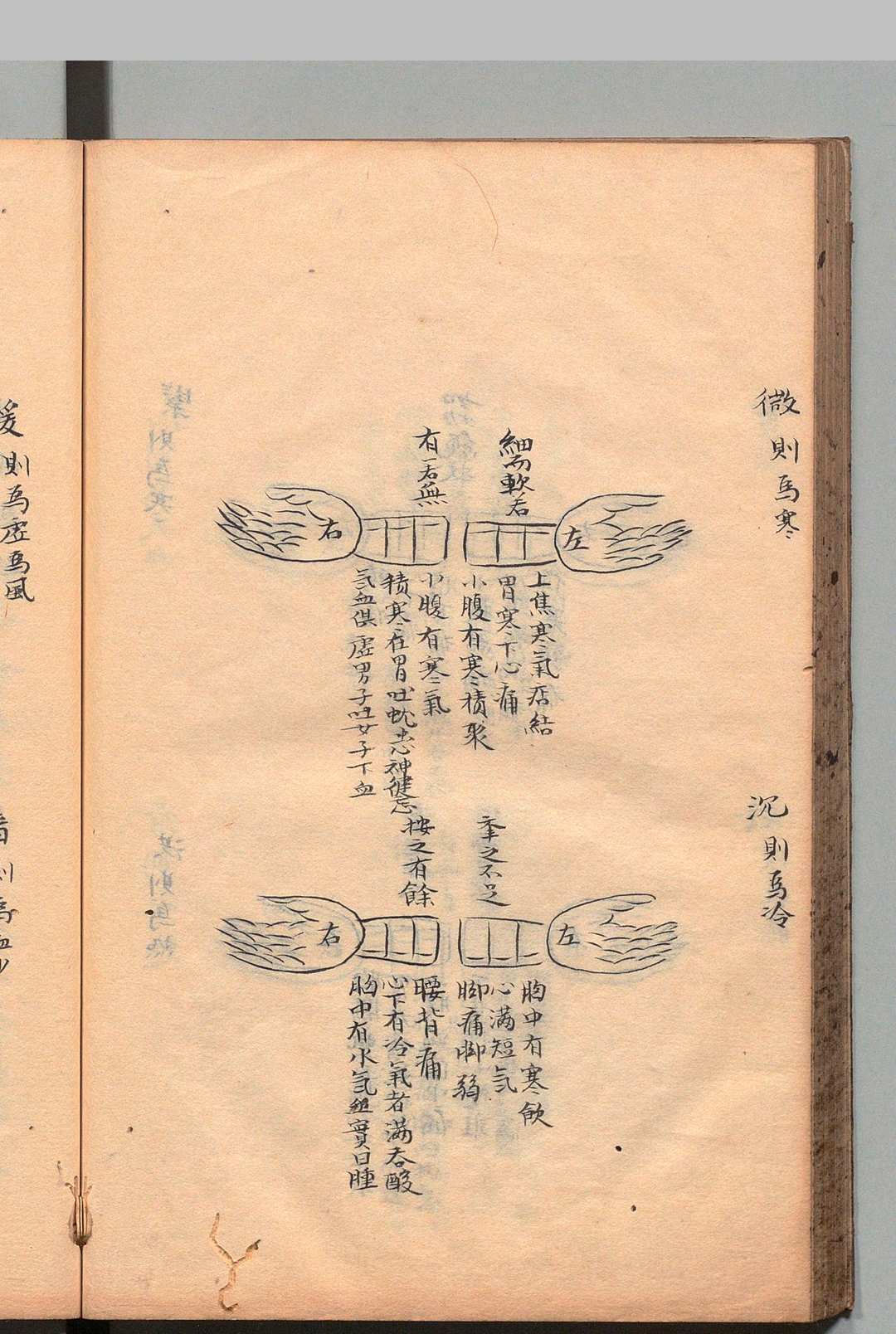 图片[6]中华古籍网-专注古书收集紫虚崔真人脉诀秘旨 １卷 附５卷 崔嘉彦（宋）写本 ,宽政3年中华古籍网-专注古书收集中华古籍网