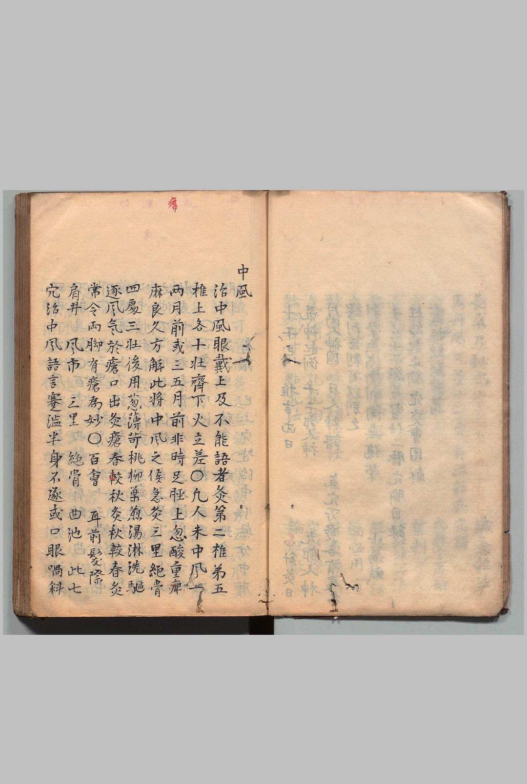 图片[5]中华古籍网-专注古书收集针灸集书 ２卷 杨珣（明）写本 ,江户中华古籍网-专注古书收集中华古籍网