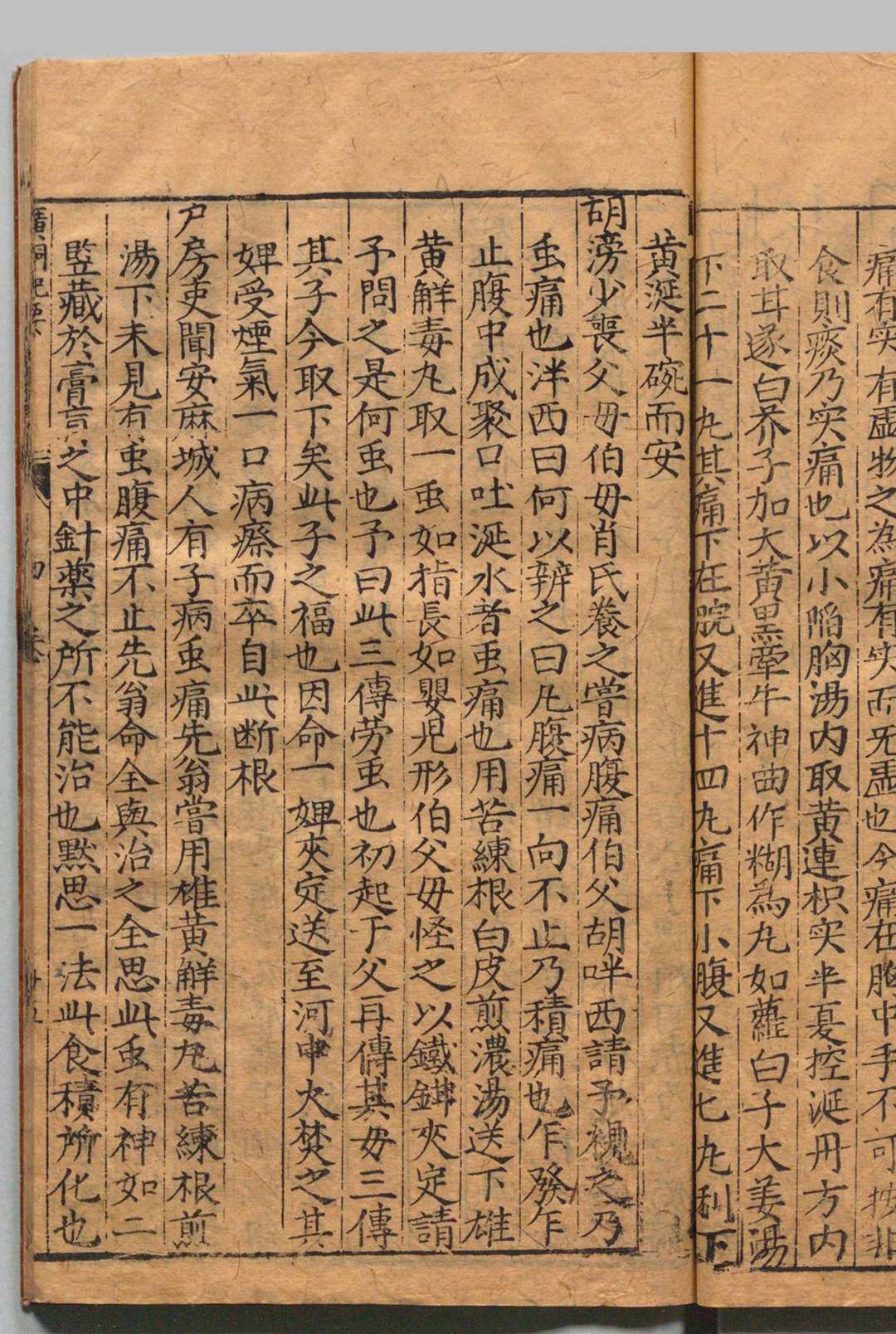 图片[9]中华古籍网-专注古书收集新刻万氏家传广嗣纪要 ５卷 万全 蔡朝衣,明万历间 , 余氏怡庆堂中华古籍网-专注古书收集中华古籍网