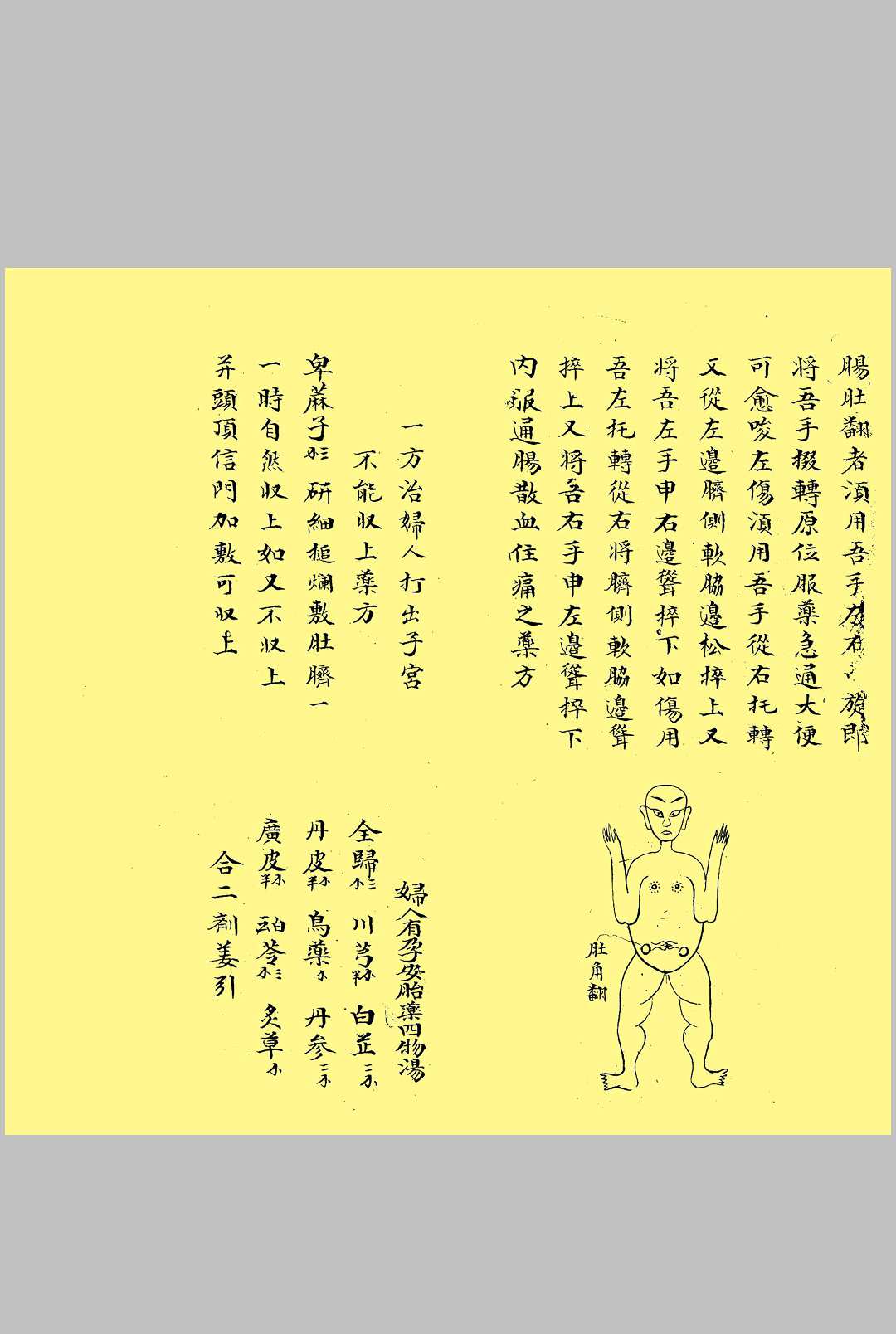 图片[14]中华古籍网-专注古书收集医理所断生死七十二总论中华古籍网-专注古书收集中华古籍网