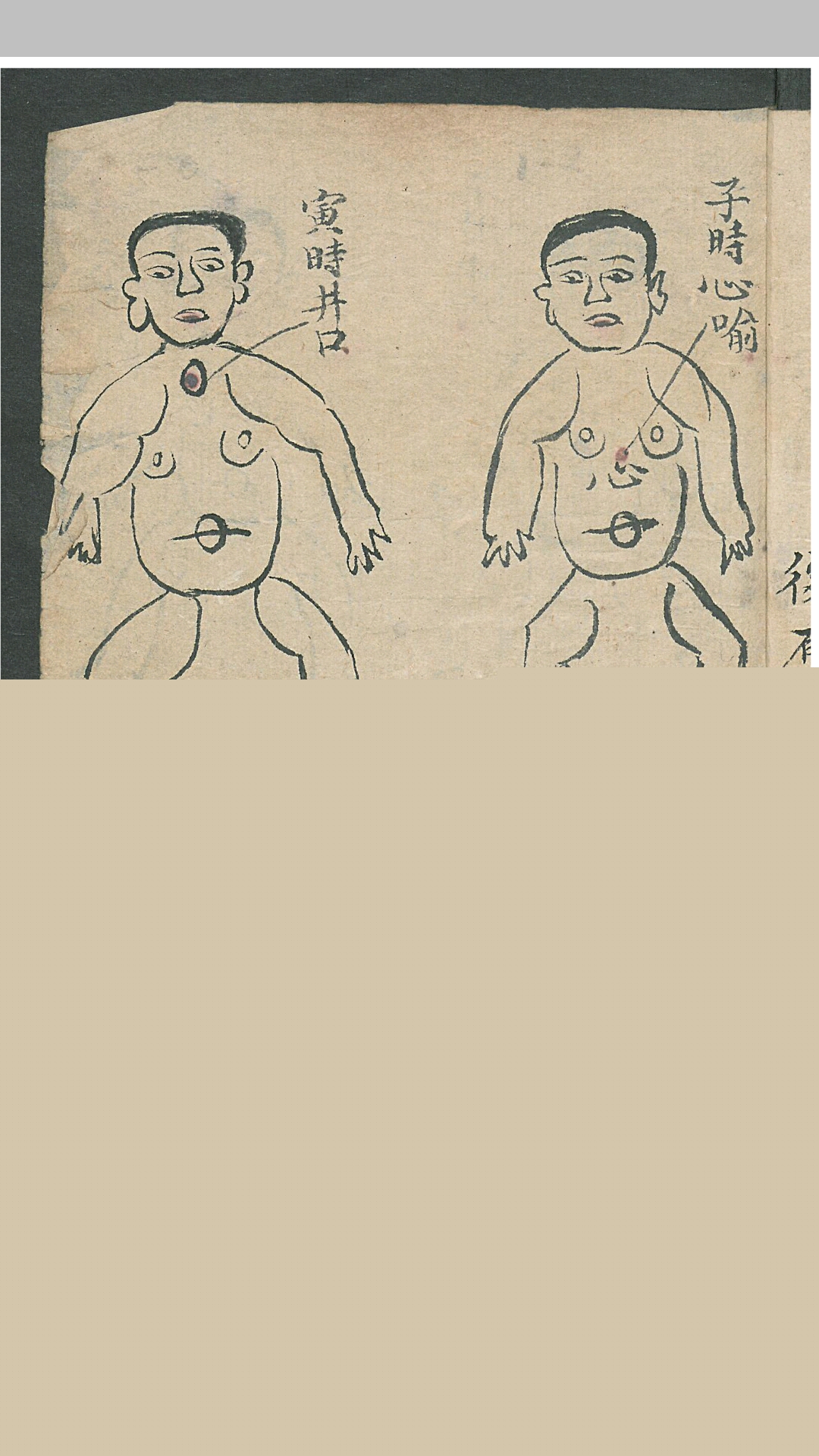 华佗