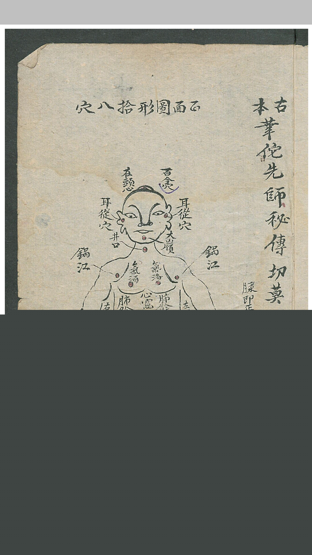 华佗