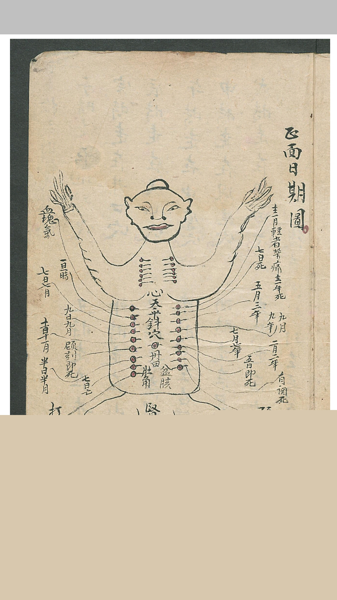 华佗