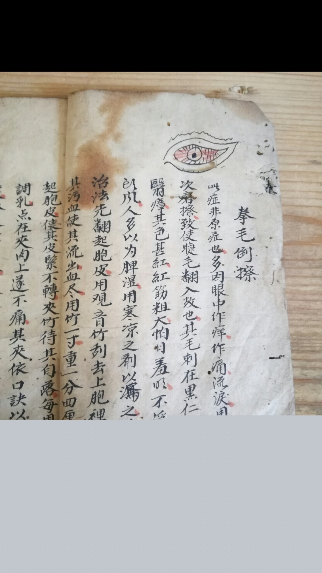 眼