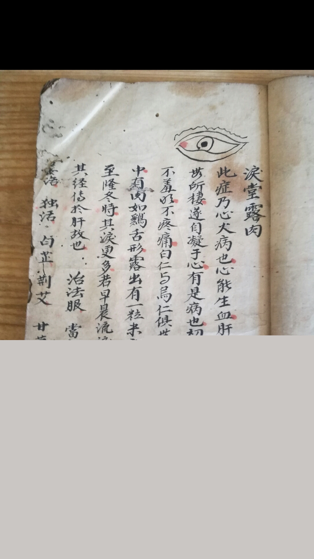 眼