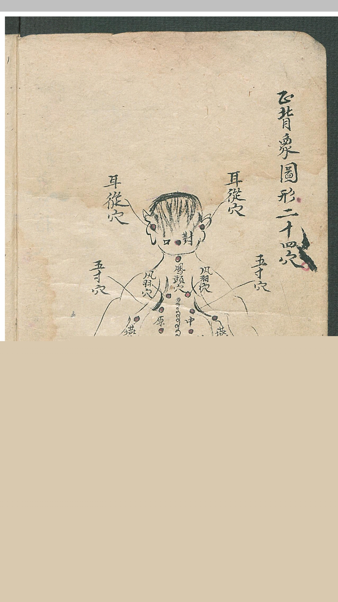 华佗