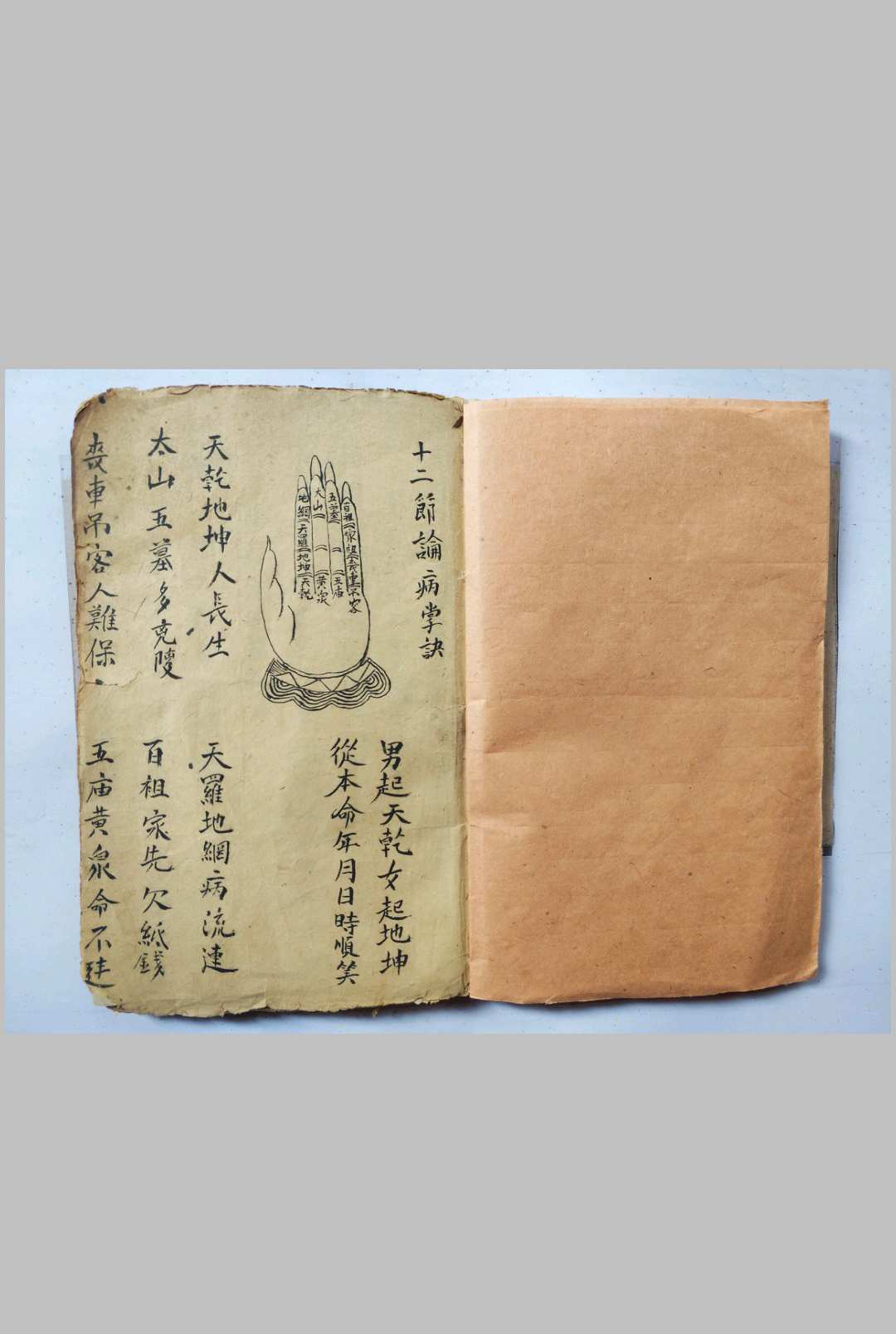 图片[2]-中华古籍网-专注古书收集辩吉断病秘诀-中华古籍网-专注古书收集中华古籍网-专注古书收集