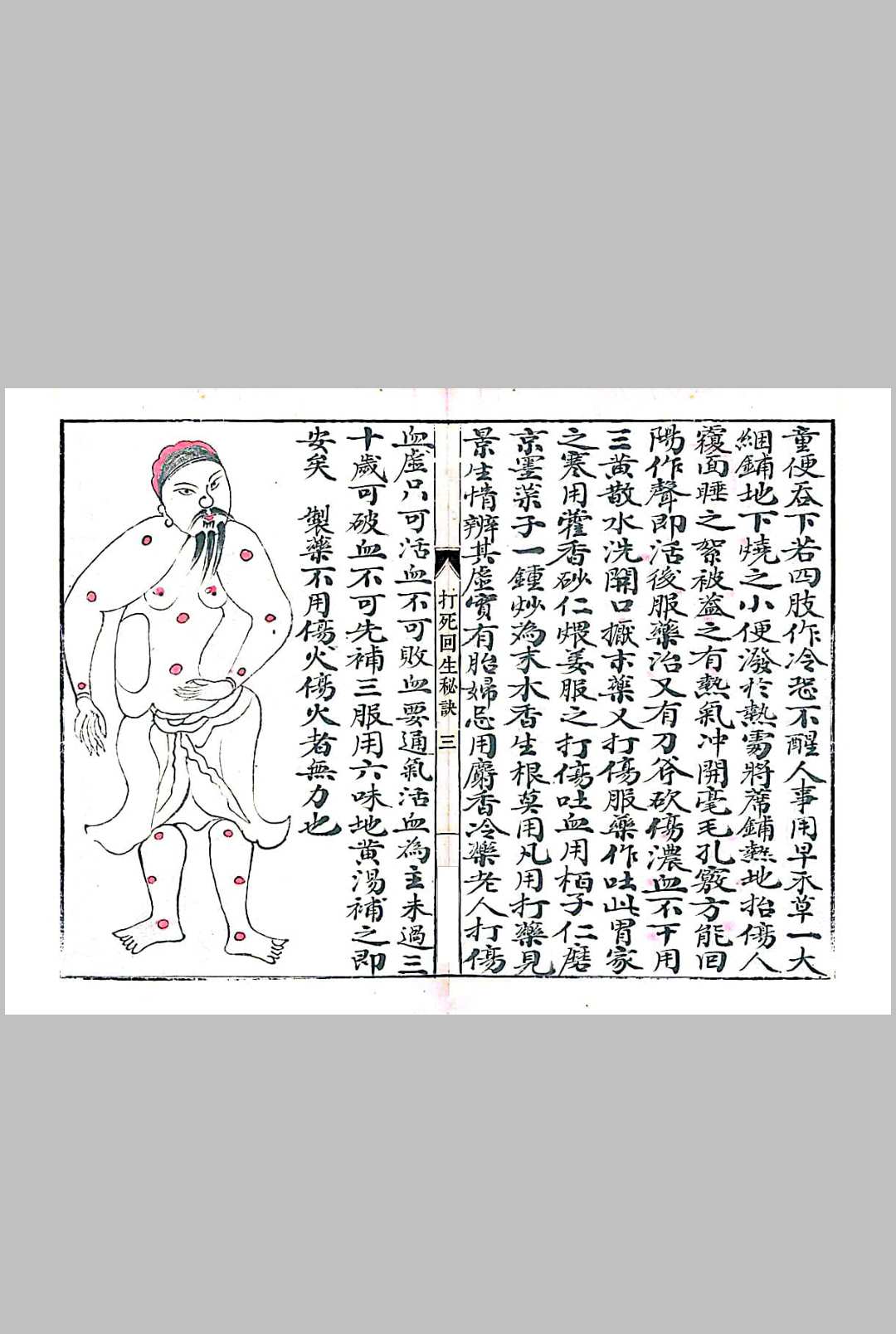 图片[8]-中华古籍网-专注古书收集打死回生秘诀-中华古籍网-专注古书收集中华古籍网-专注古书收集