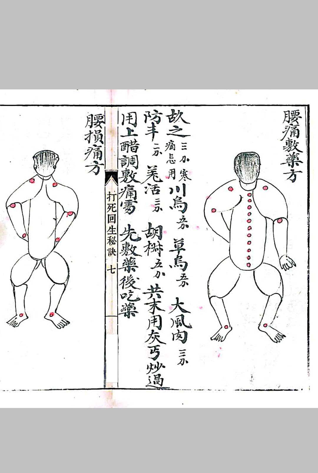 图片[4]-中华古籍网-专注古书收集打死回生秘诀-中华古籍网-专注古书收集中华古籍网-专注古书收集