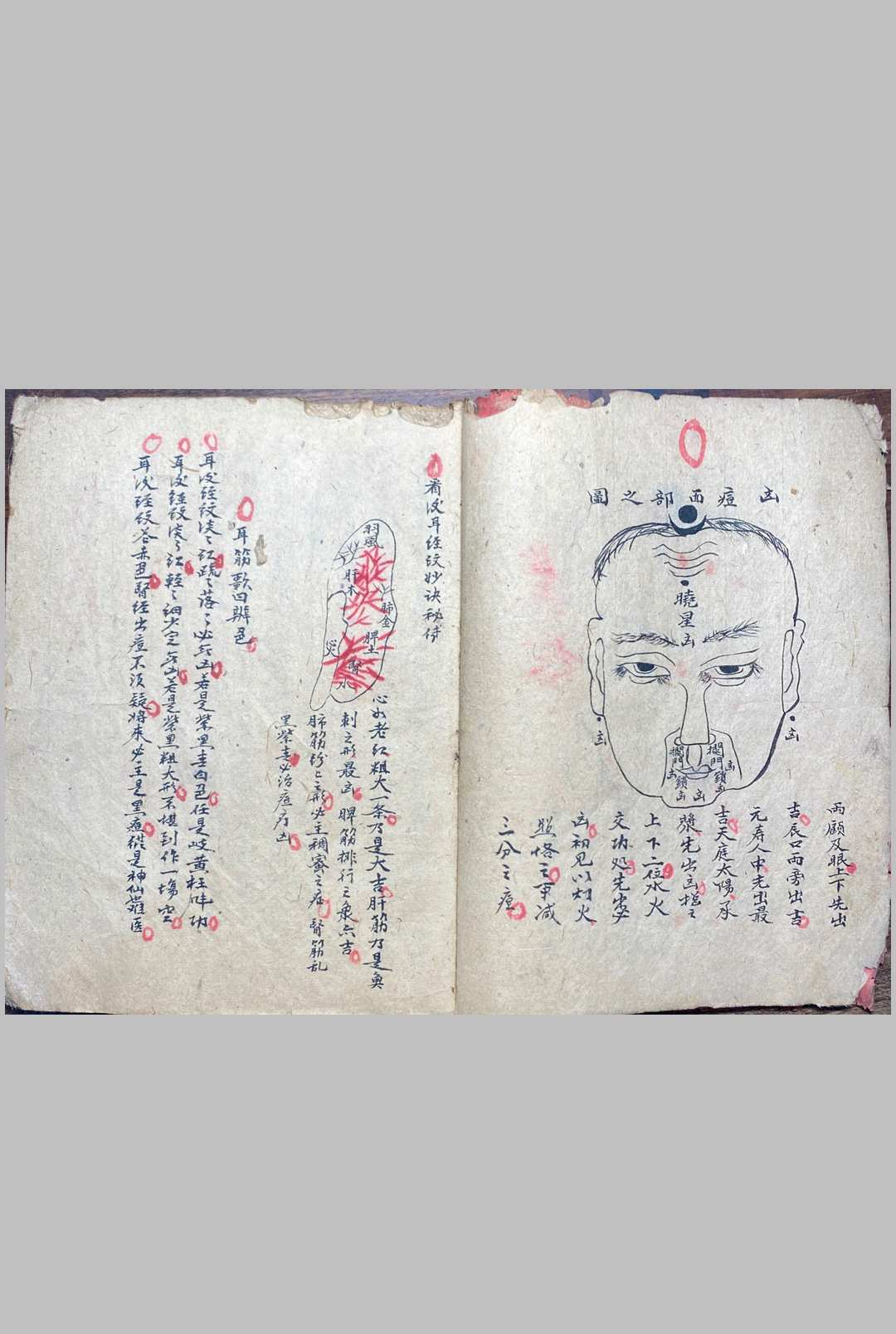 图片[4]-中华古籍网-专注古书收集妙手生春 医门广单-中华古籍网-专注古书收集中华古籍网-专注古书收集