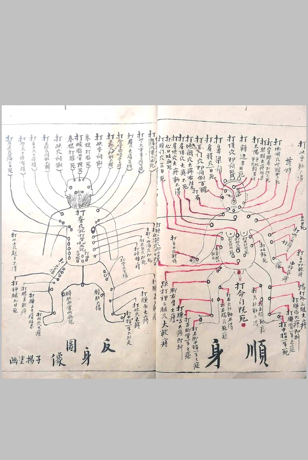 图片[4]-中华古籍网-专注古书收集遗传外科-中华古籍网-专注古书收集中华古籍网-专注古书收集