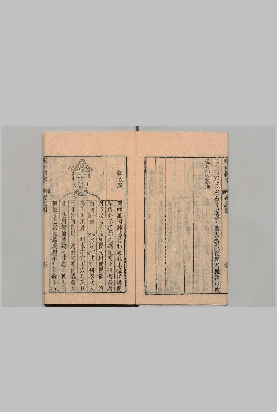 图片[6]中华古籍网-专注古书收集喉科指掌 ６卷 张宗良 清嘉庆元年中华古籍网-专注古书收集中华古籍网