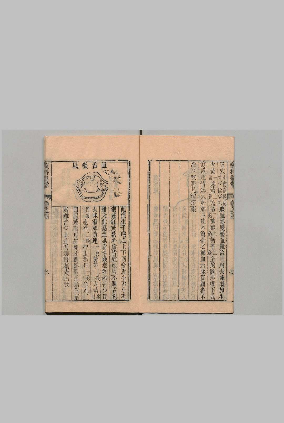 图片[8]中华古籍网-专注古书收集喉科指掌 ６卷 张宗良 清嘉庆元年中华古籍网-专注古书收集中华古籍网