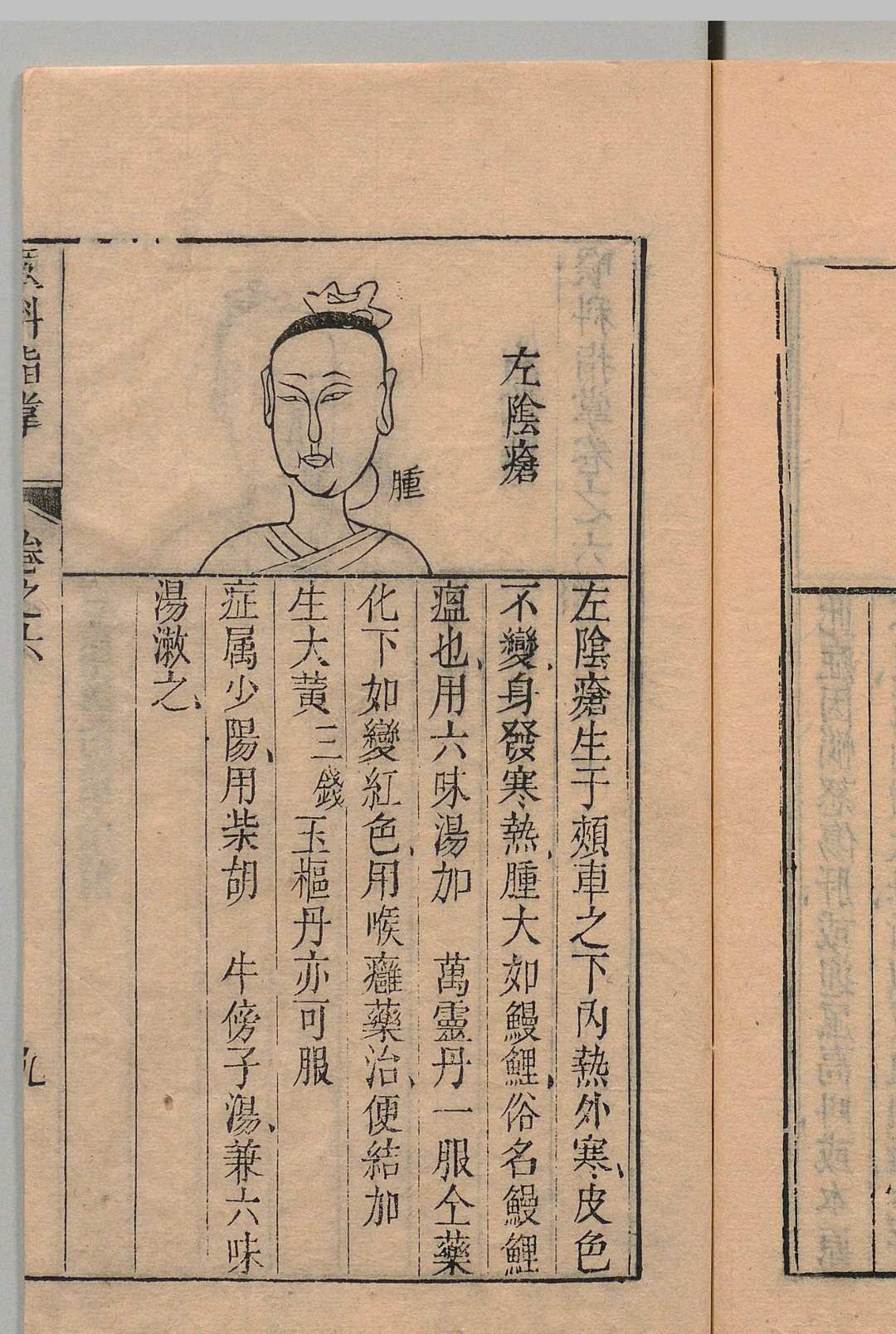 图片[11]中华古籍网-专注古书收集喉科指掌 ６卷 张宗良 清嘉庆元年中华古籍网-专注古书收集中华古籍网