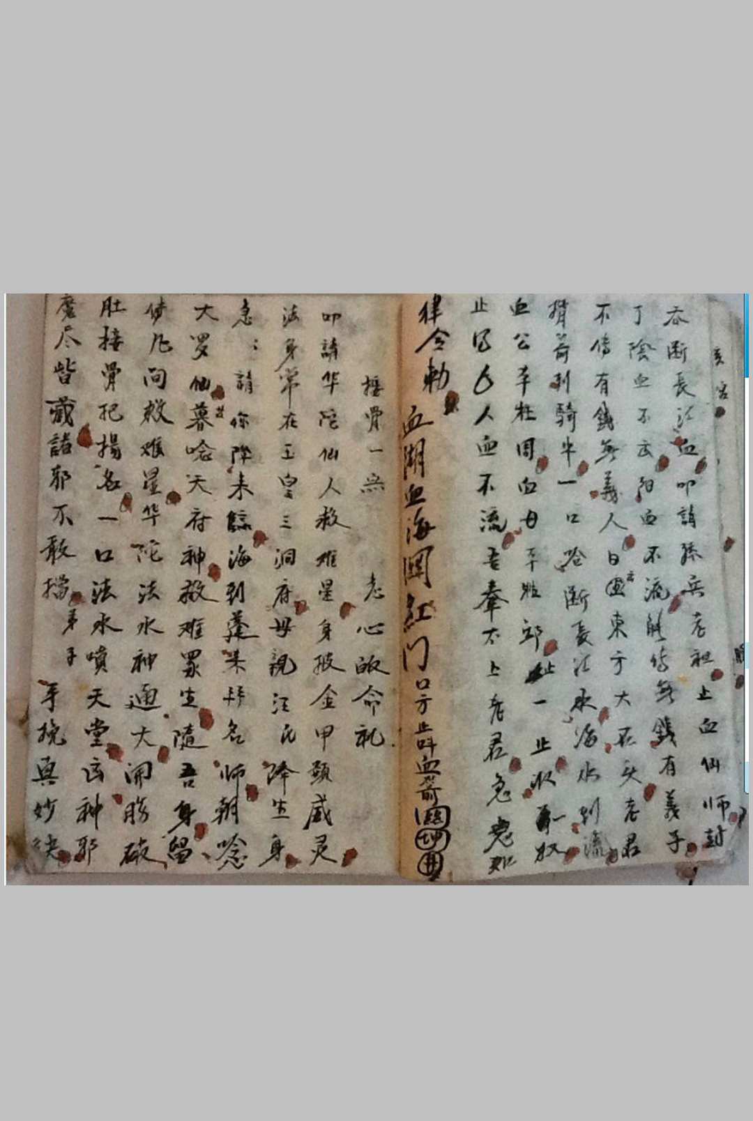 图片[10]中华古籍网-专注古书收集《手抄接骨神书》-三辰中华古籍网-专注古书收集中华古籍网