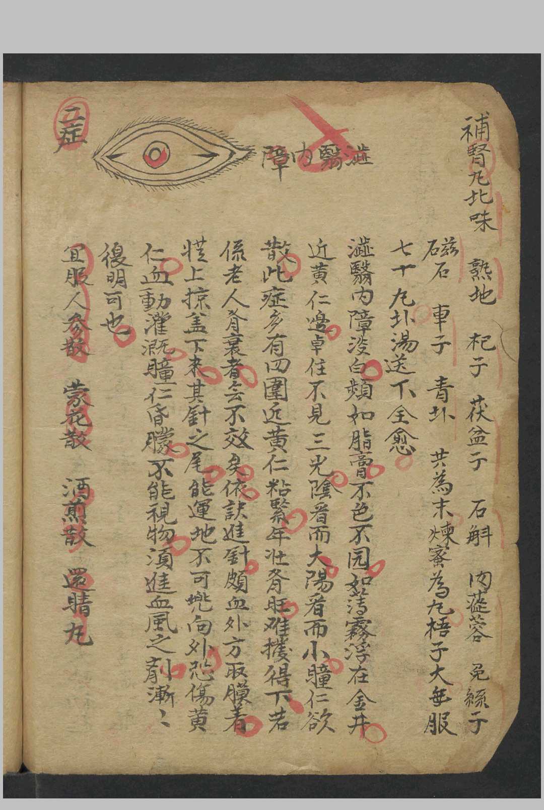 图片[4]中华古籍网-专注古书收集龙树祖师秘传眼科七拾贰症全图 , 1884中华古籍网-专注古书收集中华古籍网