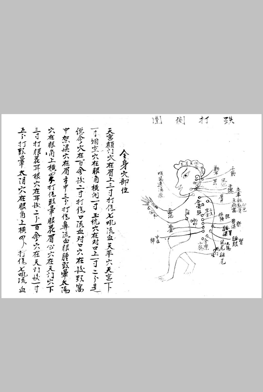 图片[4]中华古籍网-专注古书收集接骨诀法-84页中华古籍网-专注古书收集中华古籍网