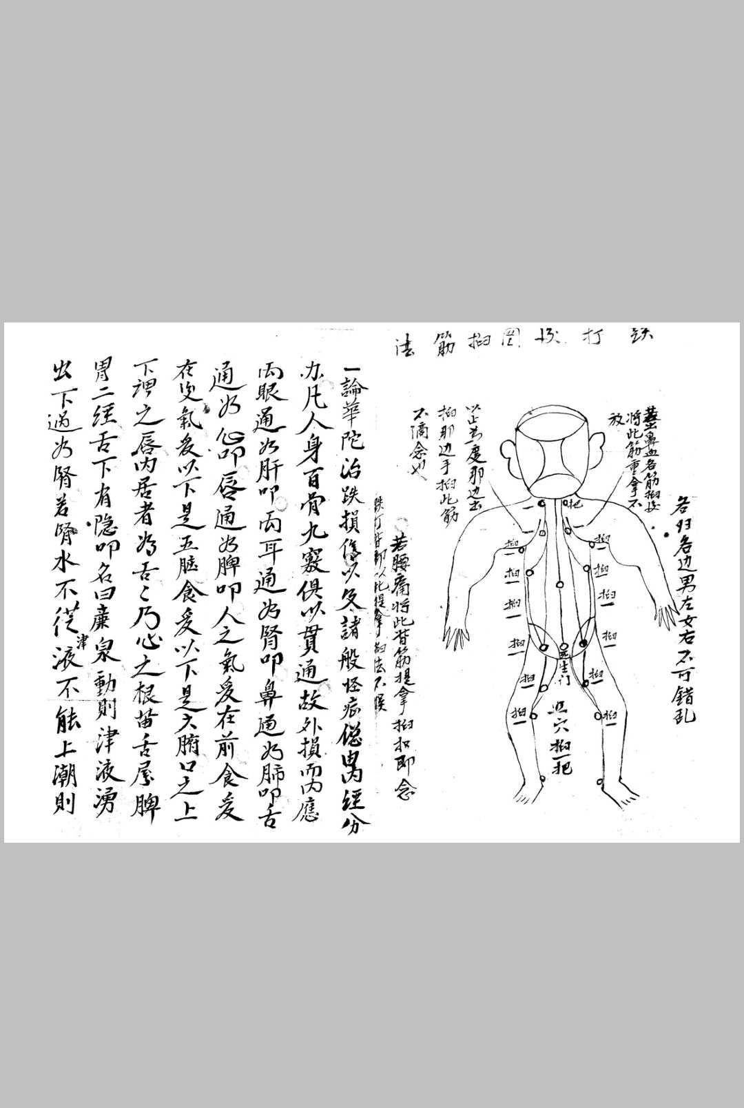 图片[13]中华古籍网-专注古书收集接骨诀法-84页中华古籍网-专注古书收集中华古籍网