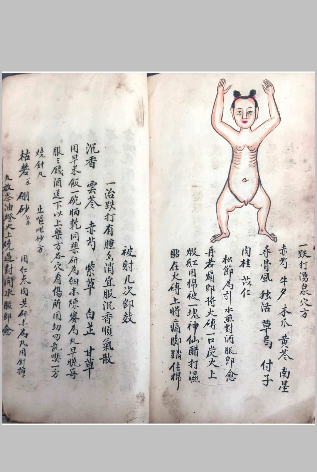 图片[10]中华古籍网-专注古书收集跌打损伤108穴秘方中华古籍网-专注古书收集中华古籍网
