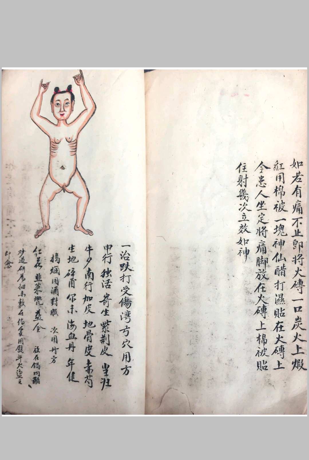 图片[14]中华古籍网-专注古书收集跌打损伤108穴秘方中华古籍网-专注古书收集中华古籍网