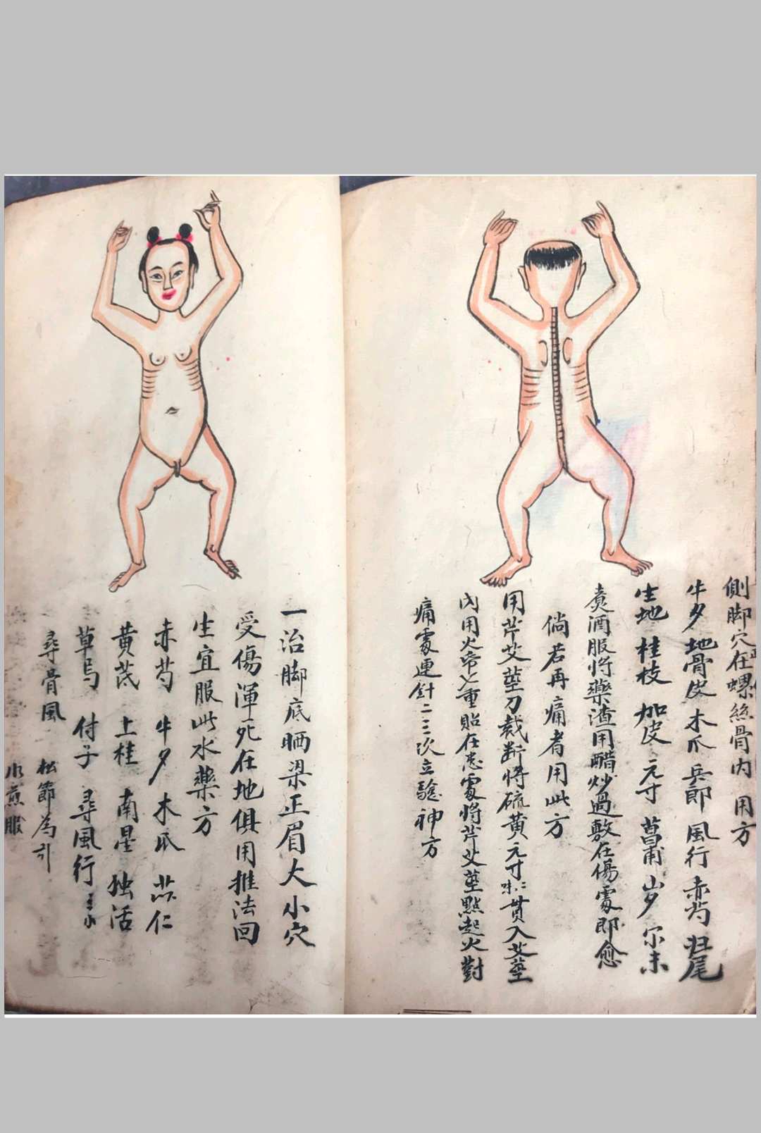 图片[15]中华古籍网-专注古书收集跌打损伤108穴秘方中华古籍网-专注古书收集中华古籍网