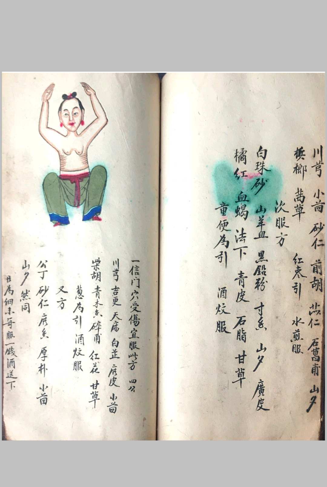 图片[13]中华古籍网-专注古书收集跌打损伤108穴秘方中华古籍网-专注古书收集中华古籍网