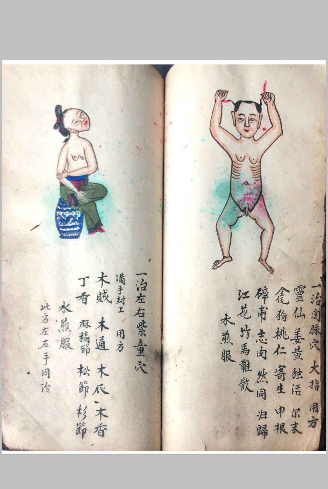 图片[11]中华古籍网-专注古书收集跌打损伤108穴秘方中华古籍网-专注古书收集中华古籍网