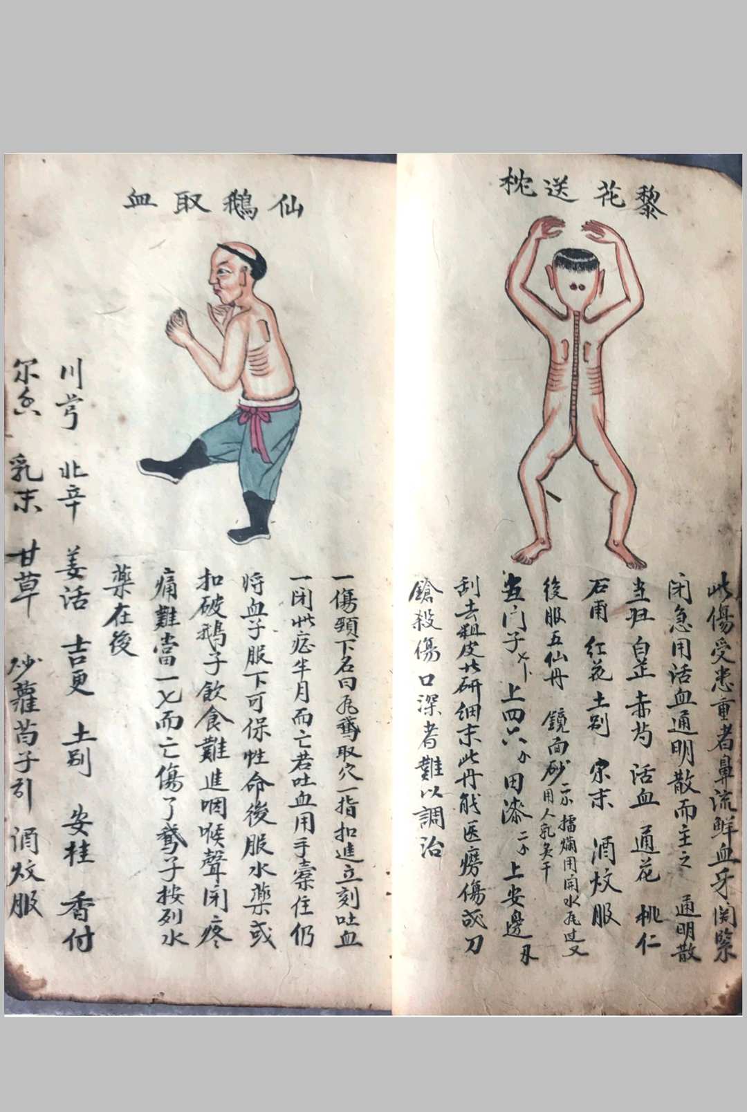图片[6]中华古籍网-专注古书收集跌打损伤108穴秘方中华古籍网-专注古书收集中华古籍网