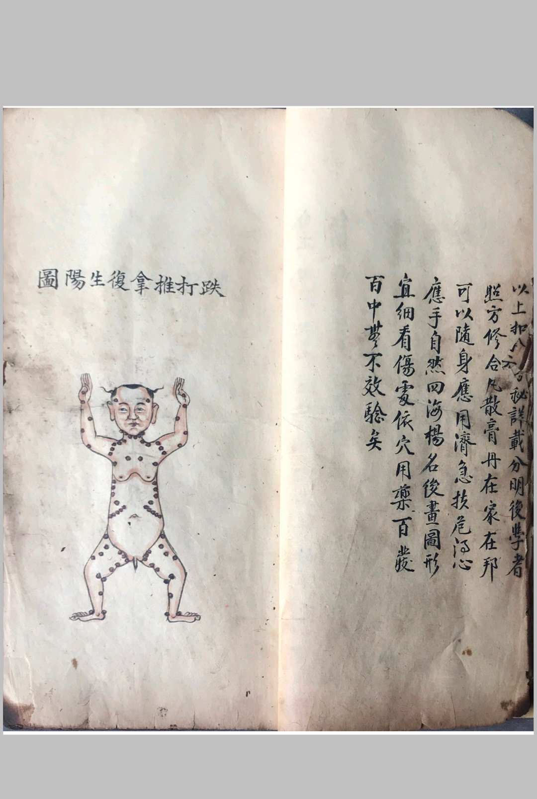 图片[4]中华古籍网-专注古书收集跌打损伤108穴秘方中华古籍网-专注古书收集中华古籍网