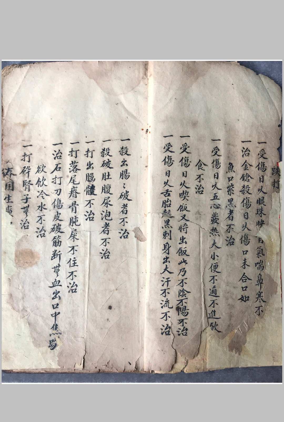图片[2]中华古籍网-专注古书收集跌打损伤108穴秘方中华古籍网-专注古书收集中华古籍网