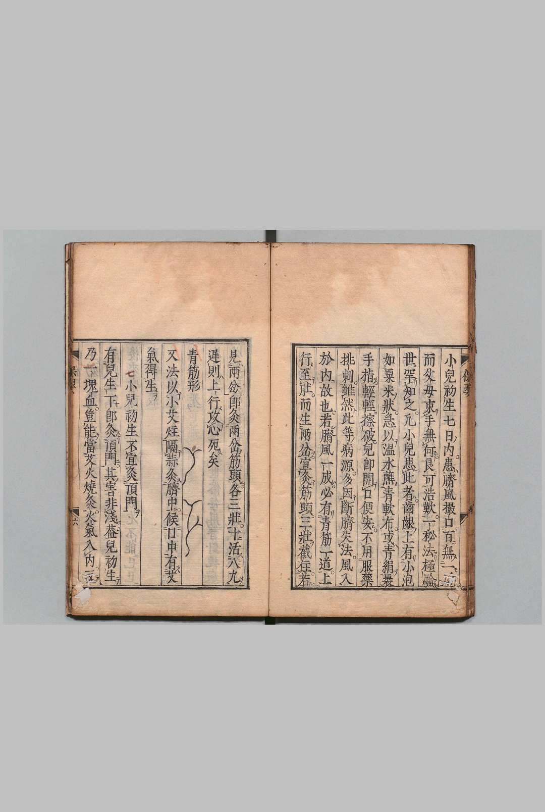 图片[7]中华古籍网-专注古书收集保婴录 １卷 山谷便方１卷 欧士海（明）刊本 ,正保3年中华古籍网-专注古书收集中华古籍网