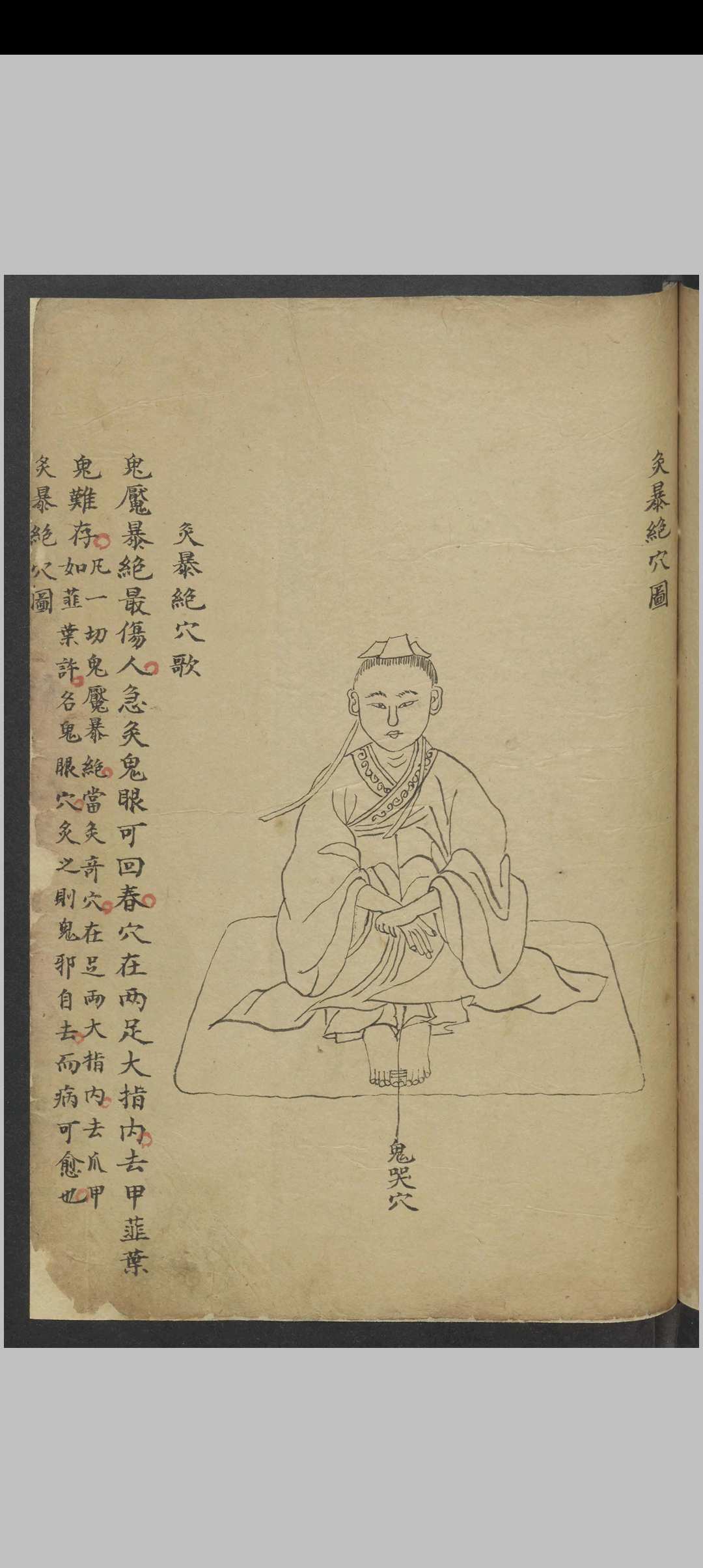 图片[22]中华古籍网-专注古书收集针灸经络汇抄 , 1900中华古籍网-专注古书收集中华古籍网