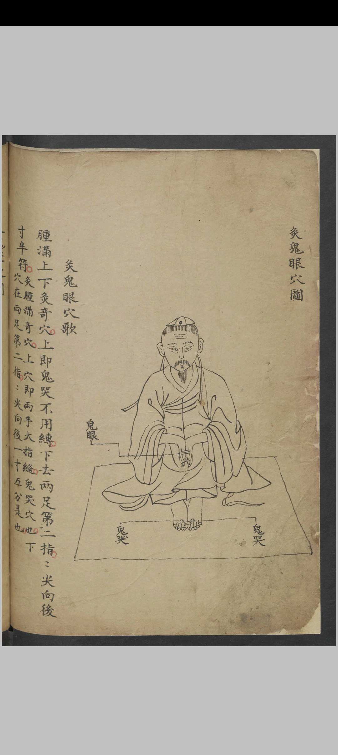 图片[19]中华古籍网-专注古书收集针灸经络汇抄 , 1900中华古籍网-专注古书收集中华古籍网