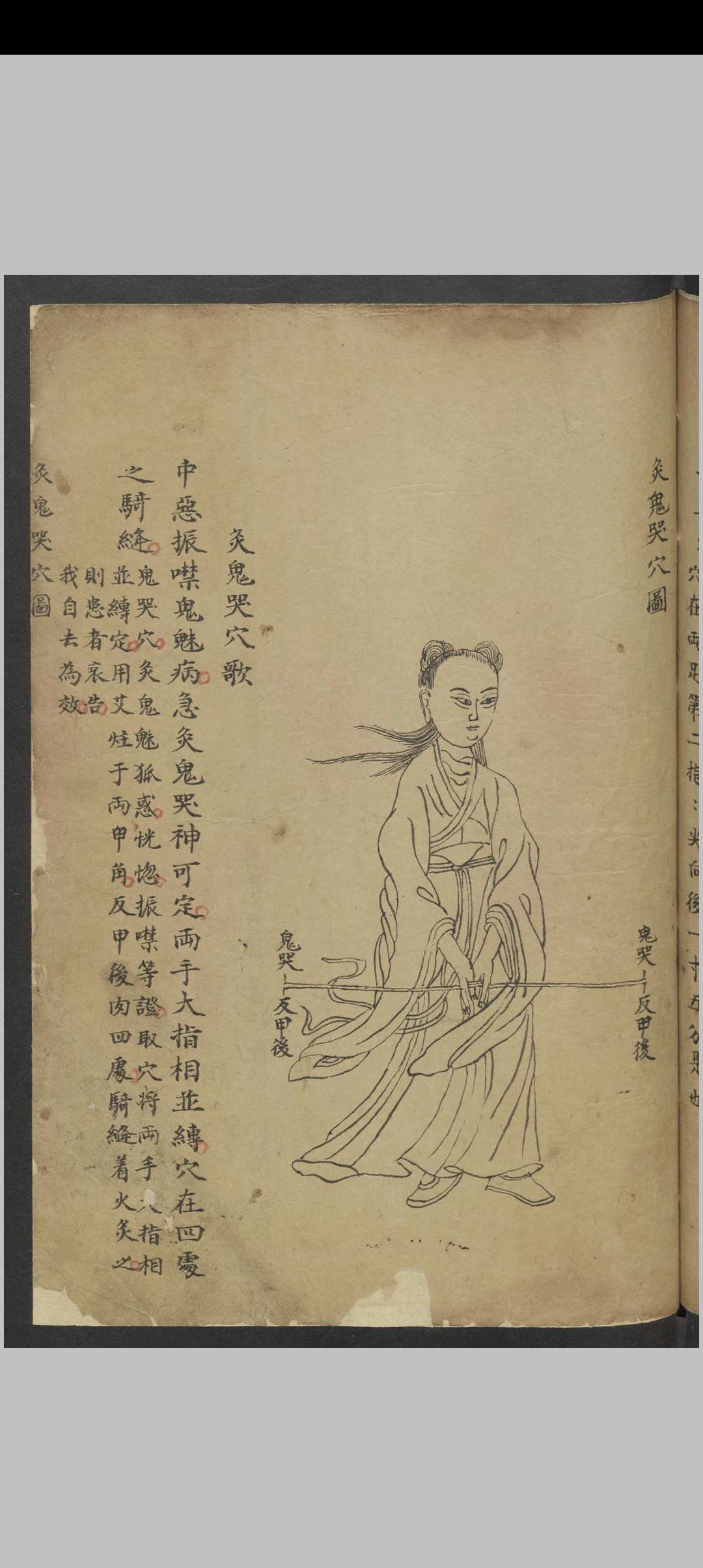 图片[20]中华古籍网-专注古书收集针灸经络汇抄 , 1900中华古籍网-专注古书收集中华古籍网