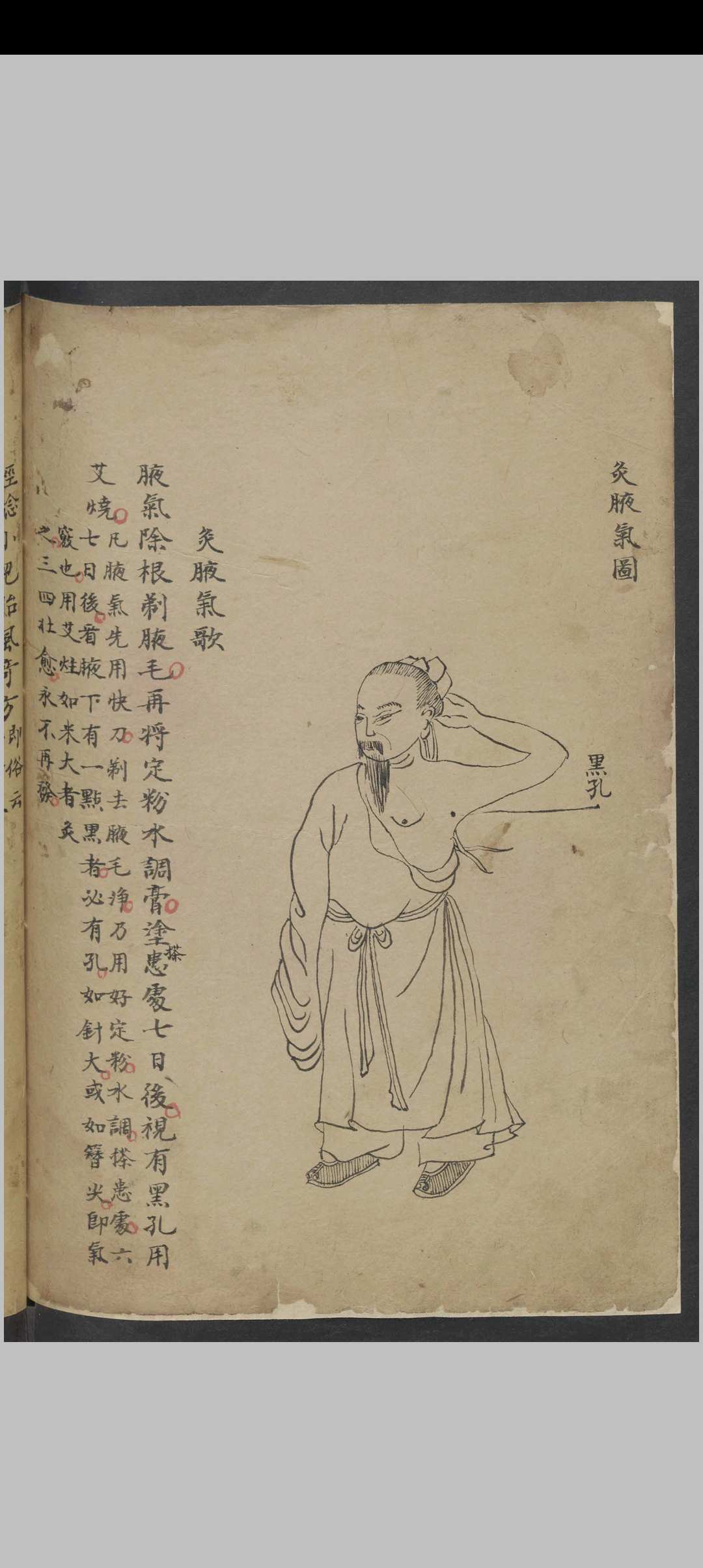 图片[21]中华古籍网-专注古书收集针灸经络汇抄 , 1900中华古籍网-专注古书收集中华古籍网